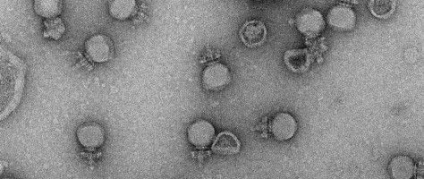 Brazilian company develops sustainable alternative to antibiotics for livestock