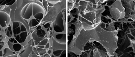 Graphene ‘scaffold’ recruits bone cells and helps the body regenerate fractures