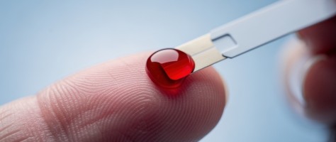 Gotas de sangue podem antecipar o sinal de alerta contra o câncer